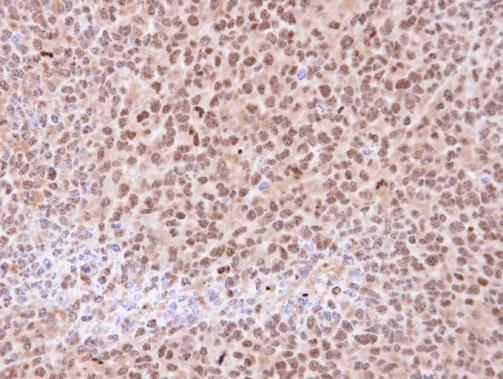 Immunohistochemistry (Formalin/PFA-fixed paraffin-embedded sections) - Anti-Proteasome subunit alpha type 6 antibody (ab97563), expandable thumbnail