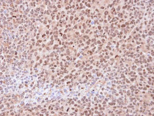 Immunohistochemistry (Formalin/PFA-fixed paraffin-embedded sections) - Anti-Proteasome subunit alpha type 6 antibody (AB97563)
