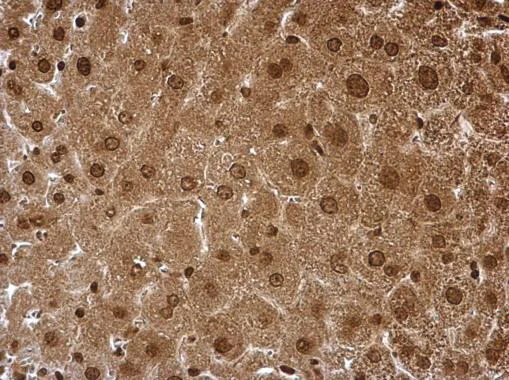 Immunohistochemistry (Formalin/PFA-fixed paraffin-embedded sections) - Anti-Proteasome subunit alpha type 6 antibody (AB97563)