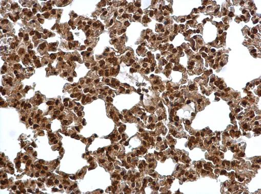 Immunohistochemistry (Formalin/PFA-fixed paraffin-embedded sections) - Anti-Proteasome subunit alpha type 6 antibody (AB97563)
