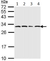 Western blot - Anti-Proteasome subunit alpha type 6 antibody (AB97563), expandable thumbnail