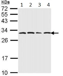 Western blot - Anti-Proteasome subunit alpha type 6 antibody (AB97563)