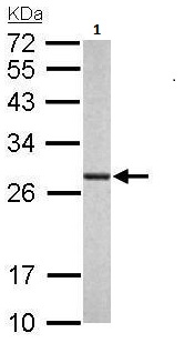 Western blot - Anti-Proteasome subunit alpha type 6 antibody (AB97563), expandable thumbnail