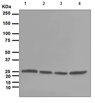 Western blot - Anti-Proteasome subunit alpha type 6 antibody [EPR5835] (AB109377)