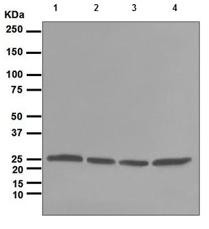 Western blot - Anti-Proteasome subunit alpha type 6 antibody [EPR5835] - BSA and Azide free (AB247839)