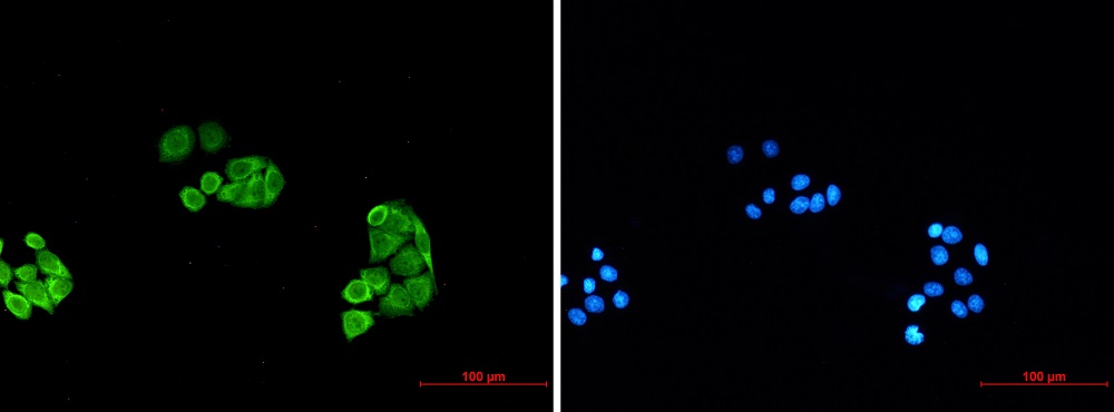 Immunocytochemistry/ Immunofluorescence - Anti-Proteasome subunit alpha type 6 Antibody [S01-4I2] (AB317398)