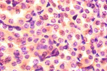 Immunohistochemistry (Formalin/PFA-fixed paraffin-embedded sections) - Anti-Proteasome subunit beta type 2/PSMB2 antibody (AB236752)