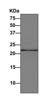 Western blot - Anti-Proteasome subunit beta type 2/PSMB2 antibody [EPR8826(2)(B)] (AB166628)