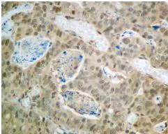 Immunohistochemistry (Formalin/PFA-fixed paraffin-embedded sections) - Anti-Proteasome subunit beta type 2/PSMB2 antibody [EPR8826(2)(B)] - BSA and Azide free (AB249366)