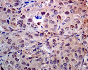 Immunohistochemistry (Formalin/PFA-fixed paraffin-embedded sections) - Anti-Proteasome subunit beta type 2/PSMB2 antibody [EPR8827] (AB137108), expandable thumbnail