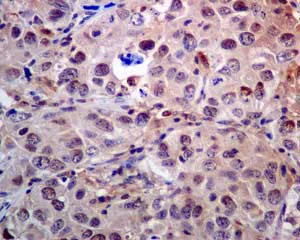 Immunohistochemistry (Formalin/PFA-fixed paraffin-embedded sections) - Anti-Proteasome subunit beta type 2/PSMB2 antibody [EPR8827] - BSA and Azide free (AB248824)