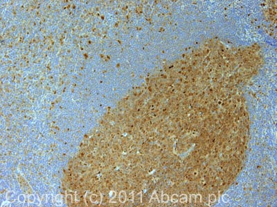 Immunohistochemistry (Formalin/PFA-fixed paraffin-embedded sections) - Anti-Proteasome subunit beta type 2/PSMB2 antibody [MCP165] (AB22650)