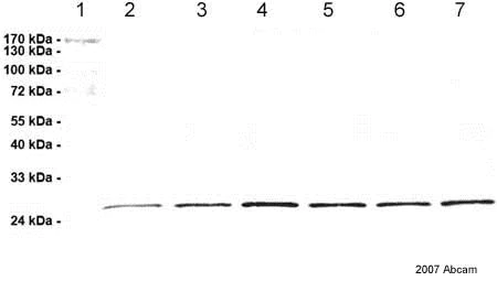 Western blot - Anti-Proteasome subunit beta type 2/PSMB2 antibody [MCP165] (AB22650)