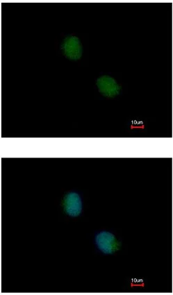 Immunocytochemistry/ Immunofluorescence - Anti-Proteasome subunit beta type-7 antibody (AB154745)