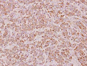 Immunohistochemistry (Formalin/PFA-fixed paraffin-embedded sections) - Anti-Proteasome subunit beta type-7 antibody (AB154745), expandable thumbnail