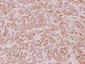 Immunohistochemistry (Formalin/PFA-fixed paraffin-embedded sections) - Anti-Proteasome subunit beta type-7 antibody (AB154745)