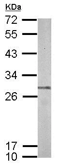 Western blot - Anti-Proteasome subunit beta type-7 antibody (AB154745)