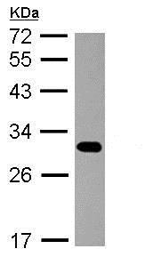 Western blot - Anti-Proteasome subunit beta type-7 antibody (AB154745), expandable thumbnail
