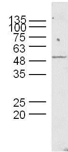 Protective protein/Cathepsin A (PPCA)抗体 (ab217857)| Abcam中文官网