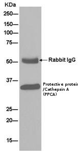 Immunoprecipitation - Anti-Protective protein/Cathepsin A (PPCA) antibody [EPR10434] (AB181129), expandable thumbnail