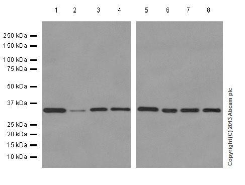 Western blot - Anti-Protective protein/Cathepsin A (PPCA) antibody [EPR10434] (AB181129), expandable thumbnail