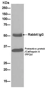 Immunoprecipitation - Anti-Protective protein/Cathepsin A (PPCA) antibody [EPR10434] - BSA and Azide free (AB250368)