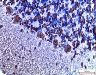 Immunohistochemistry (Formalin/PFA-fixed paraffin-embedded sections) - Protein Block (AB64226)