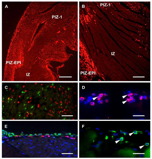 Immunohistochemistry (Formalin/PFA-fixed paraffin-embedded sections) - Protein Block (AB64226)