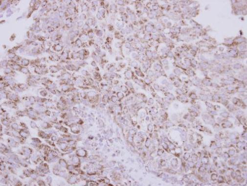 Immunohistochemistry (Formalin/PFA-fixed paraffin-embedded sections) - Anti-Protein C antibody (AB226998)
