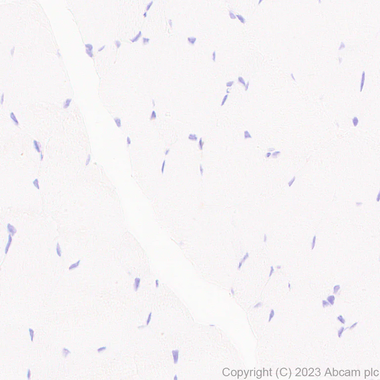 Immunohistochemistry (Formalin/PFA-fixed paraffin-embedded sections) - Anti-Protein C antibody [EPR28195-90] (AB313386)
