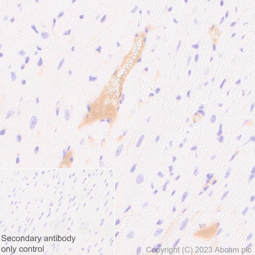 Immunohistochemistry (Formalin/PFA-fixed paraffin-embedded sections) - Anti-Protein C antibody [EPR28195-90] - BSA and Azide free (ab313387), expandable thumbnail