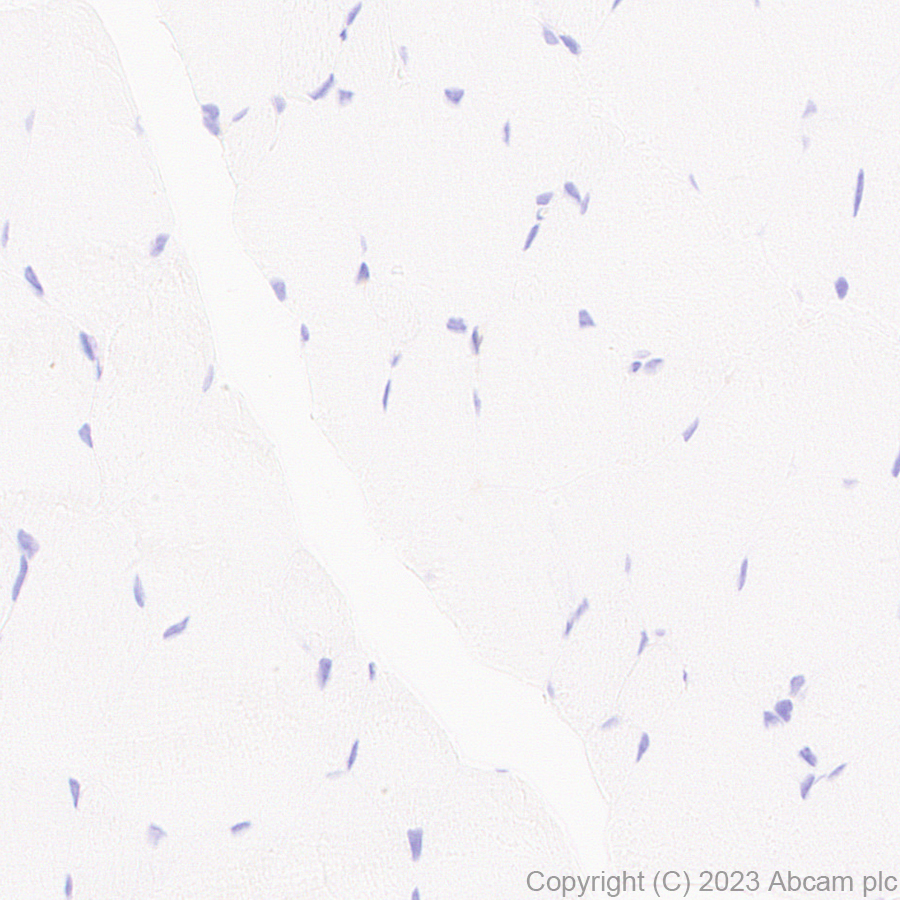 Immunohistochemistry (Formalin/PFA-fixed paraffin-embedded sections) - Anti-Protein C antibody [EPR28195-90] - BSA and Azide free (AB313387), expandable thumbnail