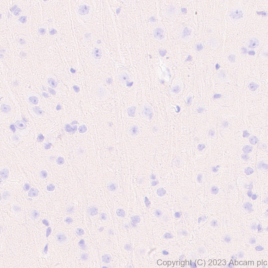 Immunohistochemistry (Formalin/PFA-fixed paraffin-embedded sections) - Anti-Protein C antibody [EPR28195-90] - BSA and Azide free (AB313387), expandable thumbnail