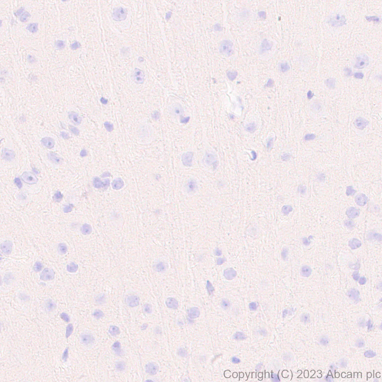 Immunohistochemistry (Formalin/PFA-fixed paraffin-embedded sections) - Anti-Protein C antibody [EPR28195-90] - BSA and Azide free (AB313387)