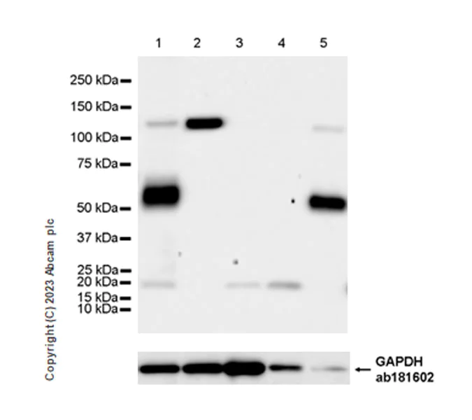 Western blot - Anti-Protein C antibody [EPR28195-90] - BSA and Azide free (AB313387)