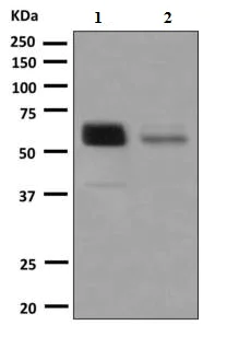Western blot - Anti-Protein C antibody [EPSISR8] (AB150373)