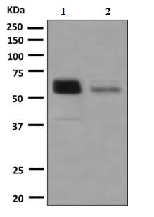 Western blot - Anti-Protein C antibody [EPSISR8] - BSA and Azide free (AB248949)
