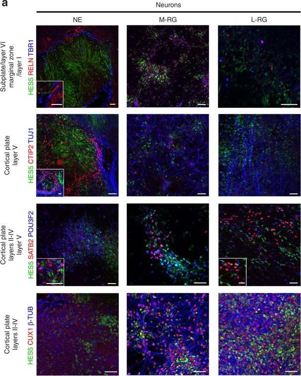 Immunocytochemistry/ Immunofluorescence - Anti-Protein CASP antibody [2A10] - BSA and Azide free (AB54583)