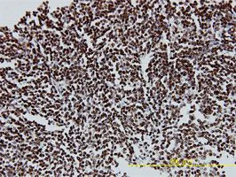 Immunohistochemistry (Formalin/PFA-fixed paraffin-embedded sections) - Anti-Protein CASP antibody [2A10] - BSA and Azide free (AB54583)