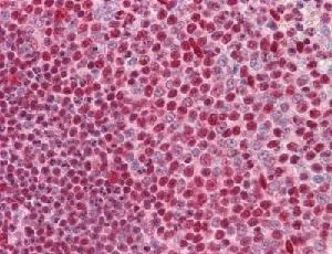 Immunohistochemistry (Formalin/PFA-fixed paraffin-embedded sections) - Anti-Protein CASP antibody [2A10] - BSA and Azide free (AB54583)