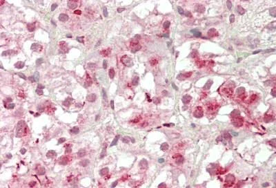 Immunohistochemistry (Formalin/PFA-fixed paraffin-embedded sections) - Anti-Protein CASP antibody (AB230844)