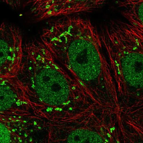 Immunocytochemistry/ Immunofluorescence - Anti-Protein CASP antibody (AB244269)