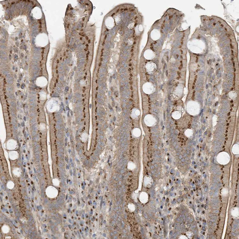 Immunohistochemistry (Formalin/PFA-fixed paraffin-embedded sections) - Anti-Protein CASP antibody (AB244269)