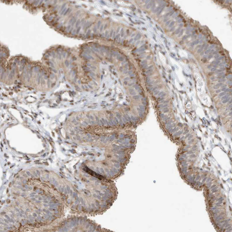 Immunohistochemistry (Formalin/PFA-fixed paraffin-embedded sections) - Anti-Protein CASP antibody (AB244269)