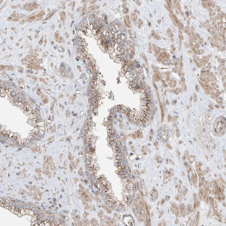 Immunohistochemistry (Formalin/PFA-fixed paraffin-embedded sections) - Anti-Protein CASP antibody (AB244269)