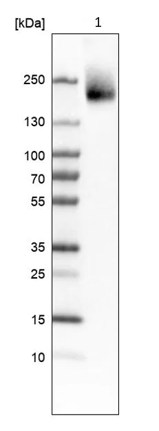 Western blot - Anti-Protein CASP antibody (AB244269)
