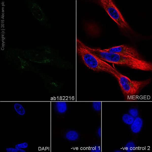 Immunocytochemistry/ Immunofluorescence - Anti-Protein CASP antibody [EPR18806] - BSA and Azide free (AB250607)