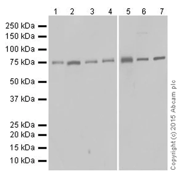 Western blot - Anti-Protein CASP antibody [EPR18806] - BSA and Azide free (AB250607)