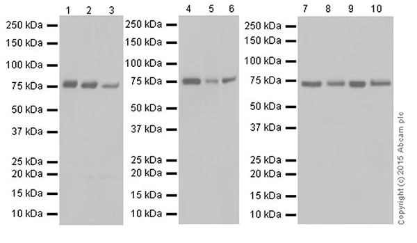 Western blot - Anti-Protein CASP antibody [EPR18806] - BSA and Azide free (AB250607)