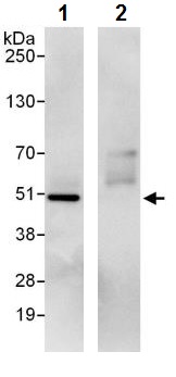 Immunoprecipitation - Anti-Protein Kinase A regulatory subunit I alpha/PRKAR1A antibody (AB245465), expandable thumbnail